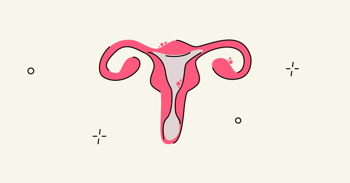 Endometriosis And Infertility Can Endometriosis Cause Infertility And Endometriosis And Infertility Can Endometriosis Cause Infertility And